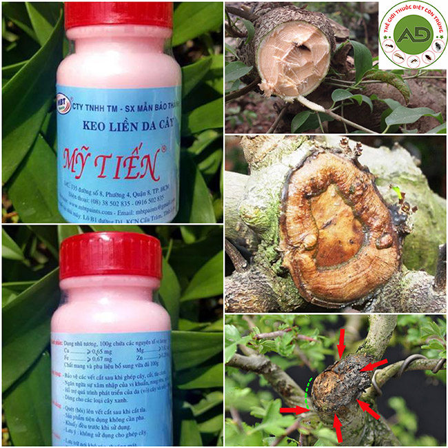 Công dụng sản phẩm keo liền sẹo cây Mỹ Tiến
